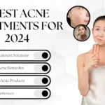 3 Revolutionary Acne Treatments for 2024