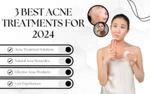 Read more about the article 3 Revolutionary Acne Treatments for 2024